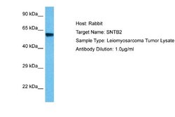 SNTB2 Antibody, Novus Biologicals 100 &mu;L; Unconjugated:Antibodies, Polyclonal